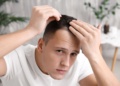 Fighting Follicle Fallout: The Truth About Male Hair Loss