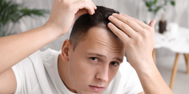 Fighting Follicle Fallout: The Truth About Male Hair Loss